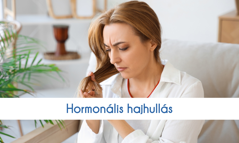 hormonális hajhullás